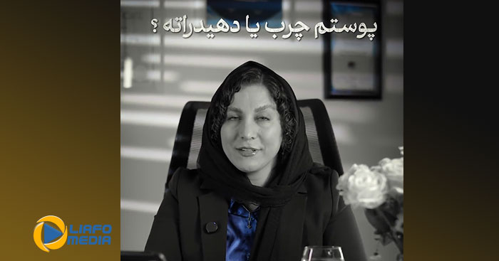 نمونه کار اینستاگرام